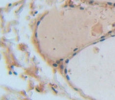 Angiogenic Factor With G Patch And FHA Domains 1 (AGGF1) Polyclonal Antibody - image 3