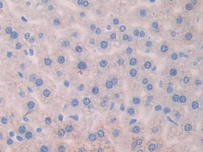 DAB staining on fromalin fixed paraffin-embedded Intestine tissue)