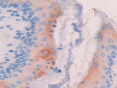 Angiogenic Factor With G Patch And FHA Domains 1 (AGGF1) Polyclonal Antibody - image 4