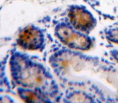 Angiogenic Factor With G Patch And FHA Domains 1 (AGGF1) Polyclonal Antibody - image 3