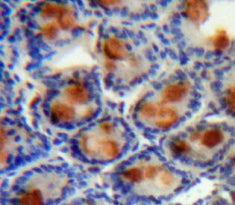 Angiogenic Factor With G Patch And FHA Domains 1 (AGGF1) Polyclonal Antibody - image 4