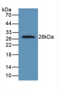 DAB staining on IHC-P; Samples: Rat Liver Tissue; Primary Ab: 20µg/ml Rabbit Anti-Rat FGFRL1 Antibody Second Ab: 2µg/mL HRP-Linked Caprine Anti-Rabbit IgG Polyclonal Antibody