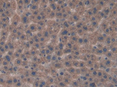 DAB staining on IHC-P; Samples: Rat Spleen Tissue.