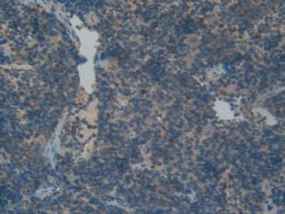 Fibroblast Growth Factor Receptor Like Protein 1 (FGFRL1) Polyclonal Antibody - image 5