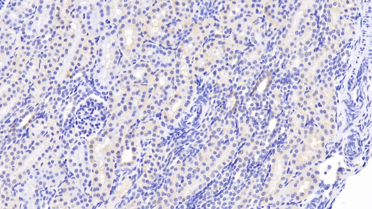 WW Domain Containing E3 Ubiquitin Protein Ligase 2 (WWP2) Polyclonal Antibody - image 3