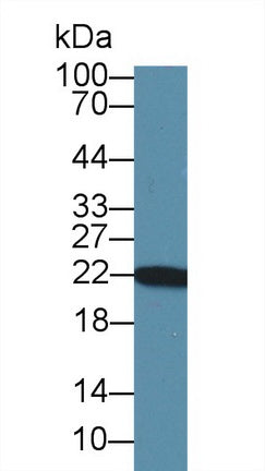 Western Blot; Sample: Recombinant protein.