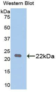 DAB staining on IHC-P; Samples: Rat Liver Tissue; Primary Ab: 20µg/ml Rabbit Anti-Rat PARK7 Antibody Second Ab: 2µg/mL HRP-Linked Caprine Anti-Rabbit IgG Polyclonal Antibody