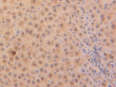 DAB staining on fromalin fixed paraffin-embedded Kidney tissue)