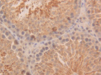 Parkinson Disease Protein 7 (PARK7) Polyclonal Antibody - image 5