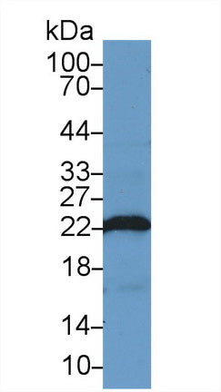 Western Blot; Sample: Recombinant protein.