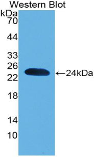 DAB staining on IHC-P; Samples: Mouse Kidney Tissue;  Primary Ab: 20µg/ml Rabbit Anti-Mouse PARK7 An