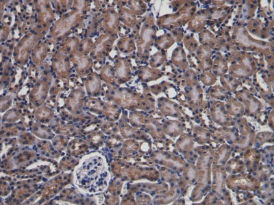 Parkinson Disease Protein 7 (PARK7) Polyclonal Antibody - image 4