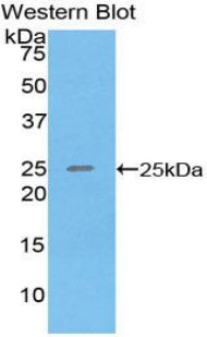 DAB staining on IHC-P; Samples: Human Liver Tissue; Primary Ab: 20µg/ml Rabbit Anti-Human SPRY3 Antibody Second Ab: 2µg/mL HRP-Linked Caprine Anti-Rabbit IgG Polyclonal Antibody