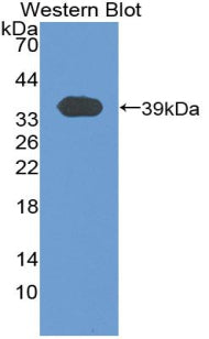 T-Kininogen 1 (KNT1) Polyclonal Antibody - image 2