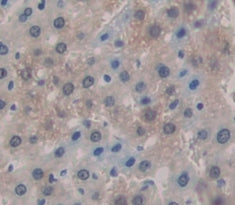 T-Kininogen 1 (KNT1) Polyclonal Antibody - image 3