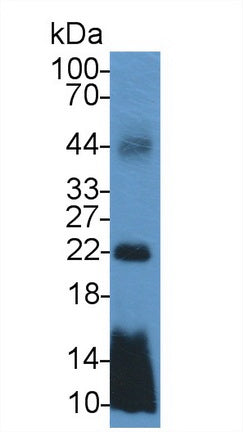 DAB staining on IHC-P; Samples: Rat Kidney Tissue;  Primary Ab: 10µg/ml Rabbit Anti-Mouse TMEM27 Ant