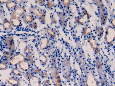 Transmembrane Protein 27 (TMEM27) Polyclonal Antibody - image 4