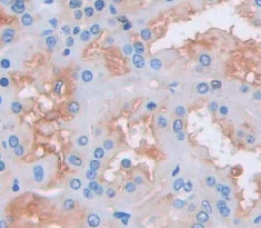 CKLF Like MARVEL Transmembrane Domain Containing Protein 1 (CMTM1) Polyclonal Antibody - image 3