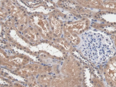 Dicer 1, Ribonuclease Type III (DICER1) Polyclonal Antibody - image 5