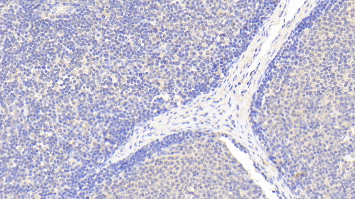 DABstainingonIHC-P.Samples:HumanTissue)