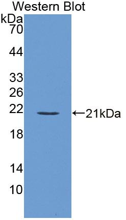 Signaling Lymphocytic Activation Molecule Family, Member 7 (SLAMF7) Polyclonal Antibody - image 2