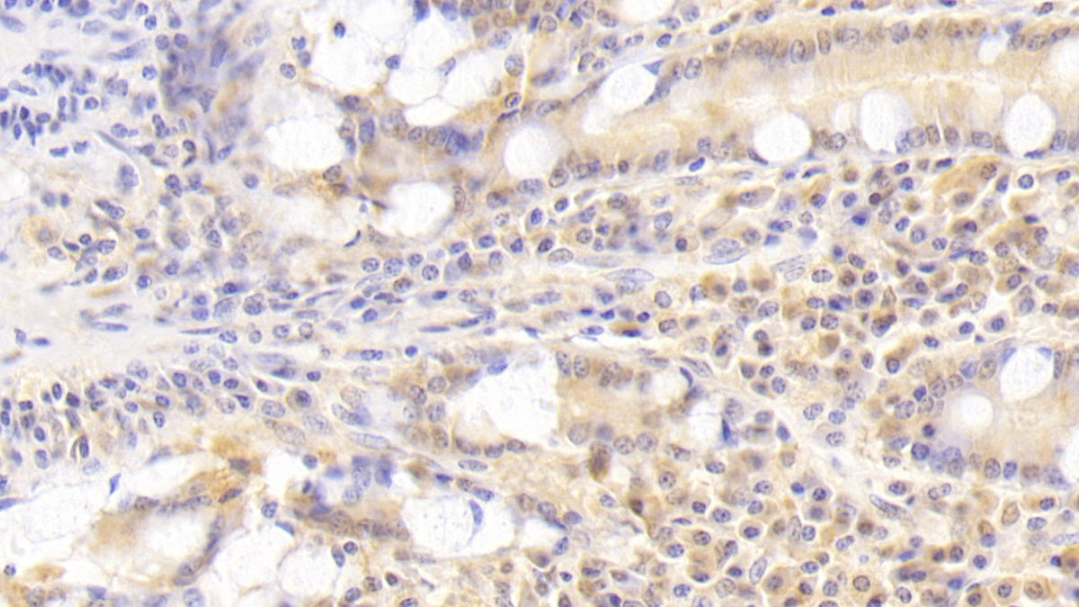 Signaling Lymphocytic Activation Molecule Family, Member 7 (SLAMF7) Polyclonal Antibody - image 3