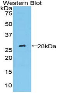 Patched Homolog 1 (PTCH1) Polyclonal Antibody - image 2