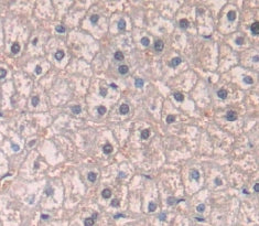 Patched Homolog 1 (PTCH1) Polyclonal Antibody - image 3