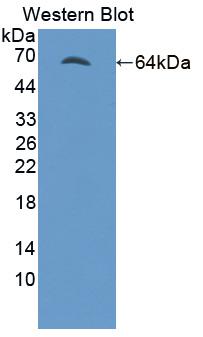 FYN Oncogene Related To SRC/FGR/YES (FYN) Polyclonal Antibody - image 2