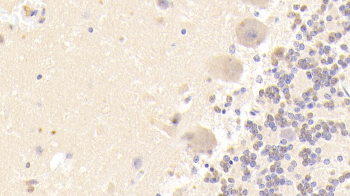DABstainingonIHC-P.Samples:HumanTissue)