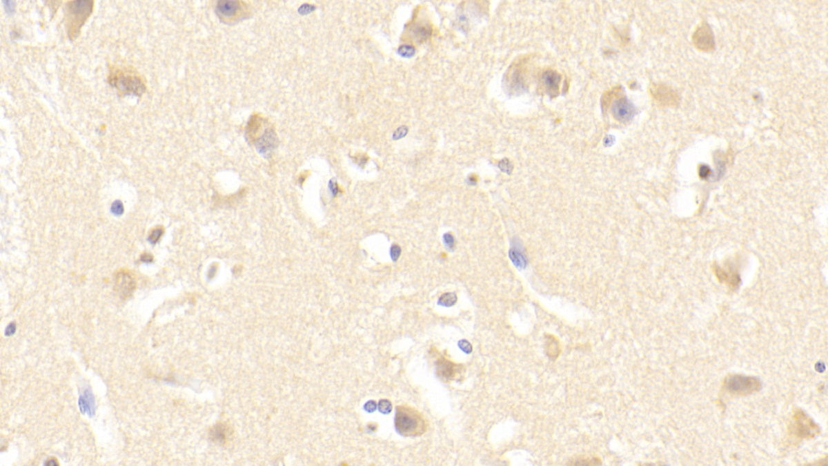 FYN Oncogene Related To SRC/FGR/YES (FYN) Polyclonal Antibody - image 4