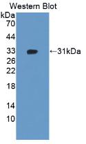 Western Blot; Sample: Human Placenta lysate; Primary Ab: 2µg/ml Rabbit Anti-Human ADAM12 Antibody; Second Ab: 0.2µg/mL HRP-Linked Caprine Anti-Rabbit IgG Polyclonal Antibody;
