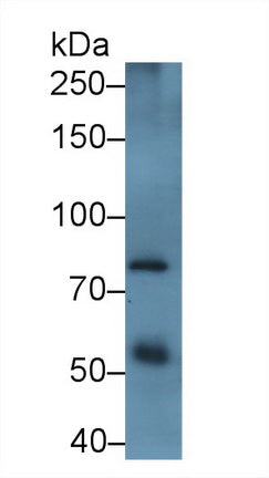 DAB staining on IHC-P; Samples: Human Placenta Tissue; Primary Ab: 20μg/ml Rabbit Anti-Human ADAM12 Antibody Second Ab: 2µg/mL HRP-Linked Caprine Anti-Rabbit IgG Polyclonal Antibody