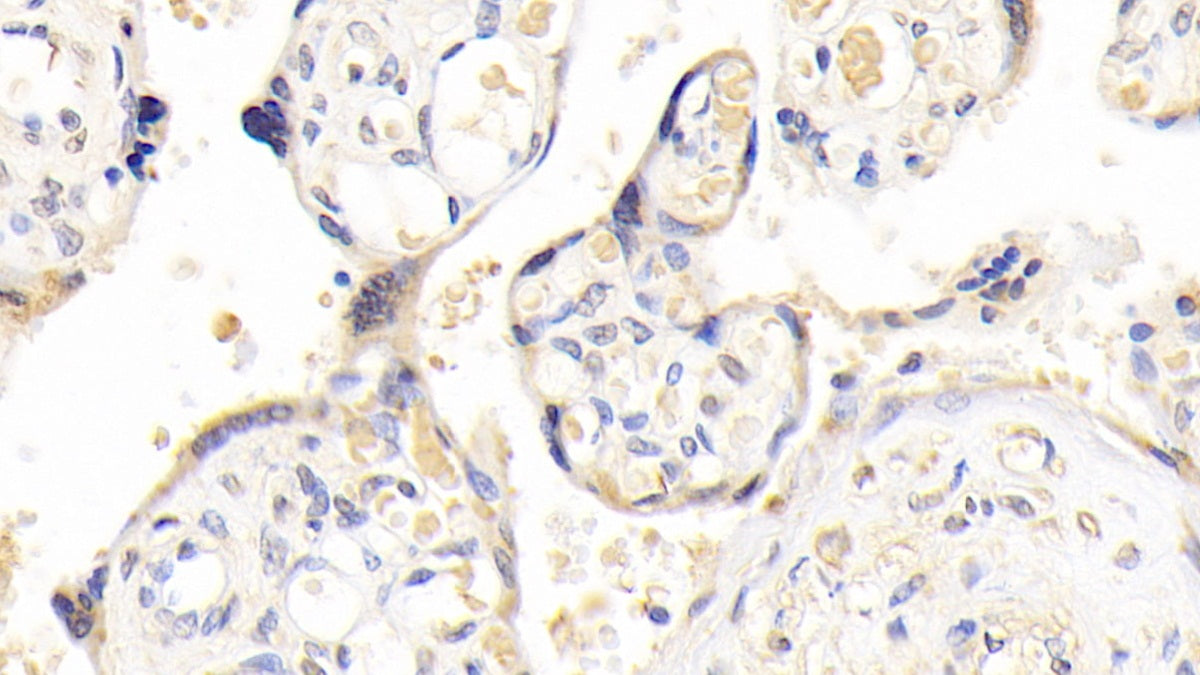 DABstainingonIHC-P.Samples:HumanTissue)