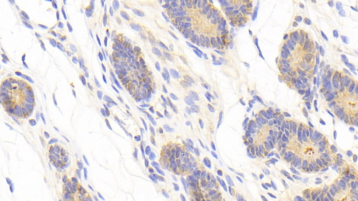 A Disintegrin And Metalloprotease 12 (ADAM12) Polyclonal Antibody - image 5