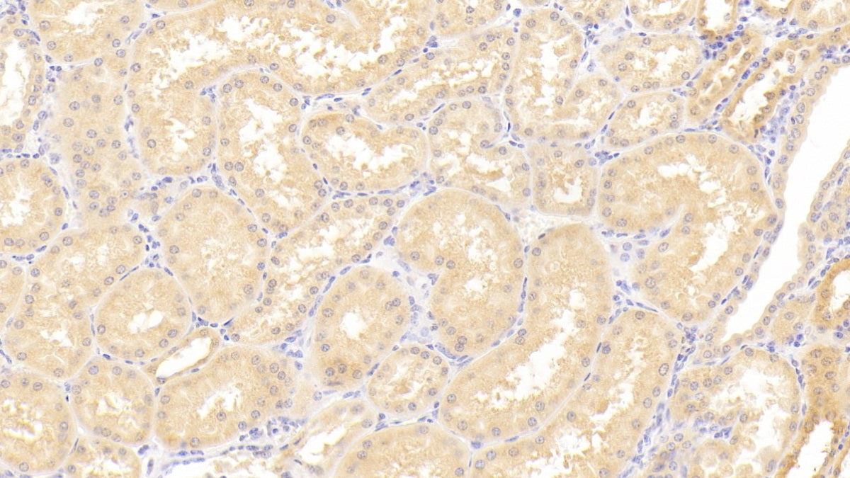 DABstainingonIHC-P.Samples:HumanTissue)