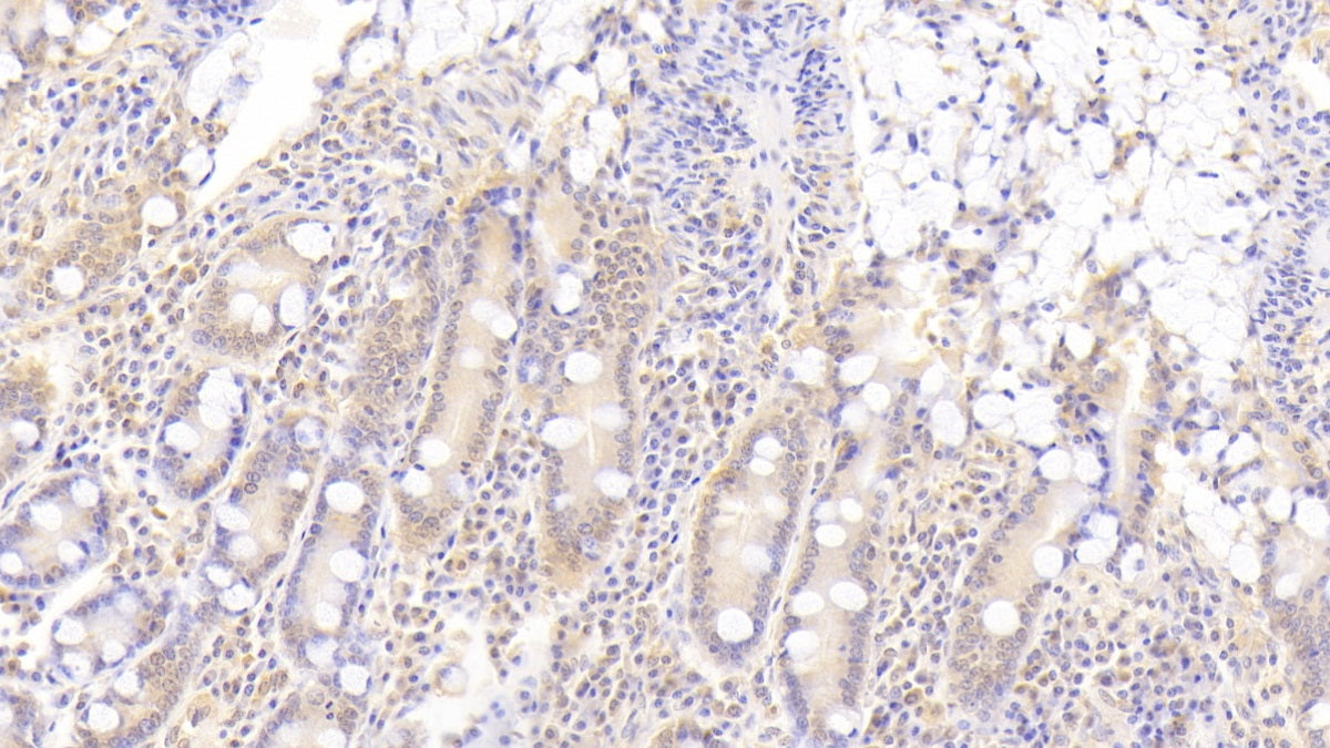A Disintegrin And Metalloproteinase With Thrombospondin 9 (ADAMTS9) Polyclonal Antibody - image 4