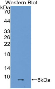 A Disintegrin And Metalloproteinase With Thrombospondin 8 (ADAMTS8) Polyclonal Antibody - image 2