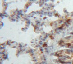 A Disintegrin And Metalloproteinase With Thrombospondin 8 (ADAMTS8) Polyclonal Antibody - image 3