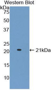 A Disintegrin And Metalloproteinase With Thrombospondin 2 (ADAMTS2) Polyclonal Antibody - image 2