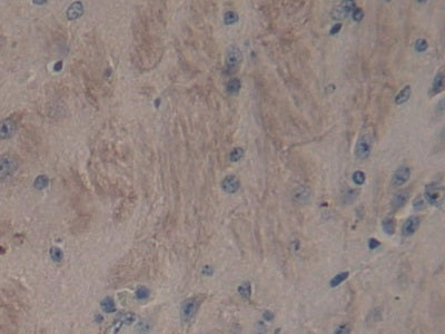A Disintegrin And Metalloproteinase With Thrombospondin 2 (ADAMTS2) Polyclonal Antibody - image 4