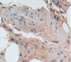 A Disintegrin And Metalloproteinase With Thrombospondin 5 (ADAMTS5) Polyclonal Antibody - image 4