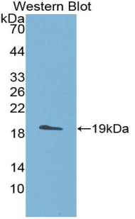 A Disintegrin And Metalloproteinase With Thrombospondin 5 (ADAMTS5) Polyclonal Antibody - image 2