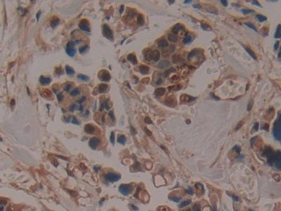 A Disintegrin And Metalloproteinase With Thrombospondin 5 (ADAMTS5) Polyclonal Antibody - image 4