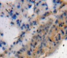 A Disintegrin And Metalloproteinase With Thrombospondin 4 (ADAMTS4) Polyclonal Antibody - image 3