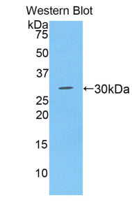 A Disintegrin And Metalloprotease 28 (ADAM28) Polyclonal Antibody - image 2
