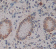 A Disintegrin And Metalloprotease 28 (ADAM28) Polyclonal Antibody - image 3