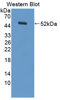 DAB staining on IHC-P; Samples: Human Stomach Tissue; Primary Ab: 10µg/ml Rabbit Anti-Human PES1 Antibody Second Ab: 2µg/mL HRP-Linked Caprine Anti-Rabbit IgG Polyclonal Antibody