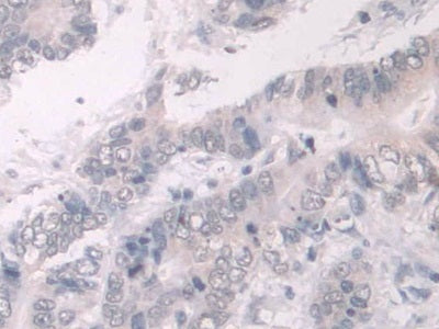 Pescadillo Homolog 1 (PES1) Polyclonal Antibody - image 5
