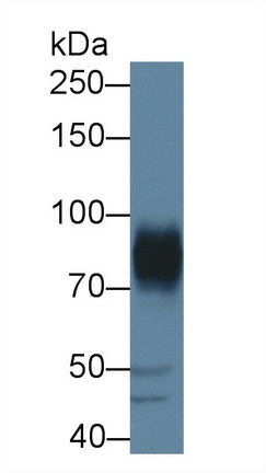 Western Blot; Sample: Recombinant protein.